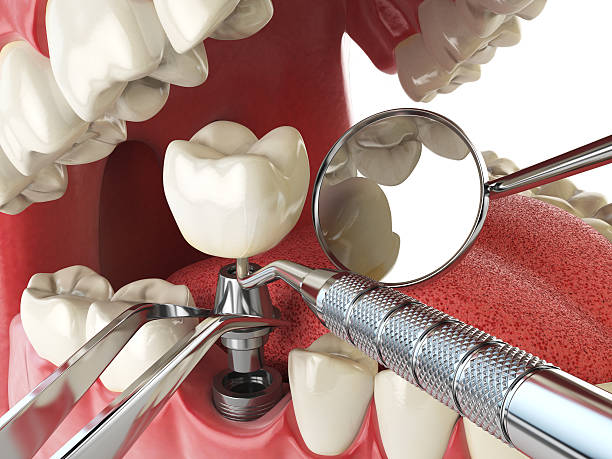 Best Emergency Cosmetic Dentistry in Burtonsville, MD